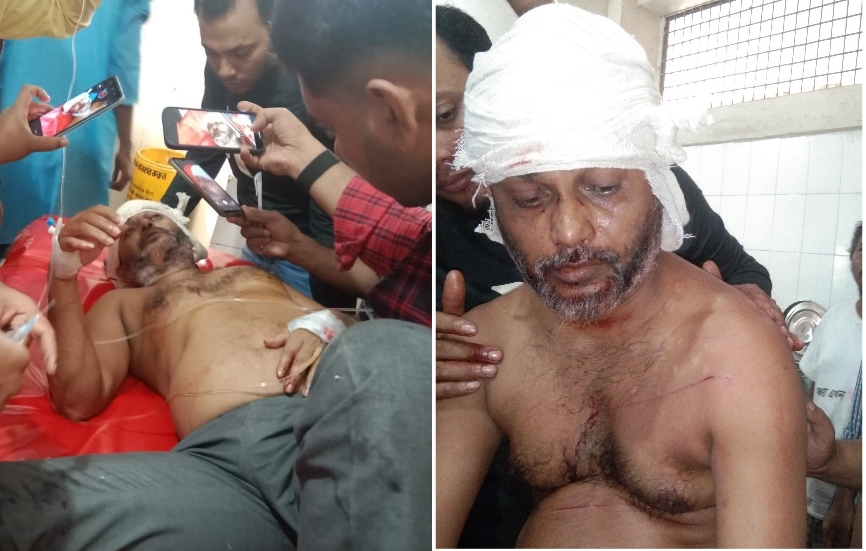 বাউফলে যুবদল নেতাকে কুপিয়ে জখম